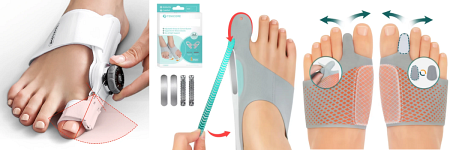 Hallux Valgus: Was ist besser, orthopädische Einlagen oder Schuhe?