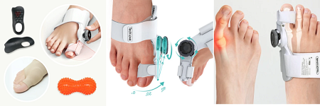 Hallux Valgus: Was ist besser, orthopädische Einlagen oder Schuhe?